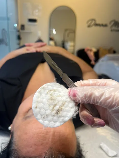 Dermaplaning: foto 1 de atendimento