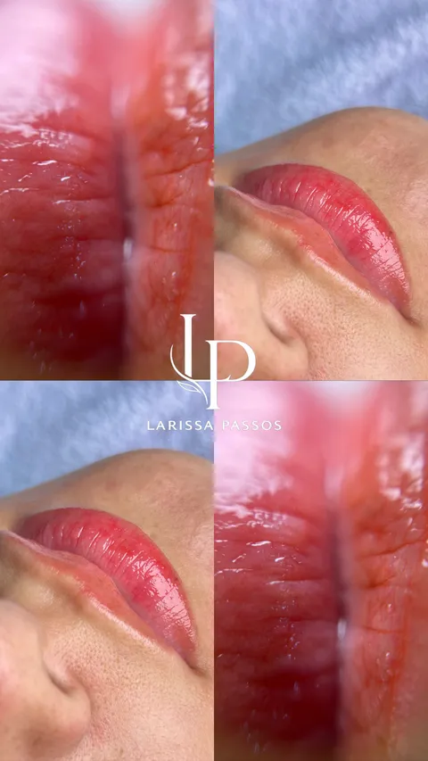 Hydra Gloss: foto 1 de atendimento